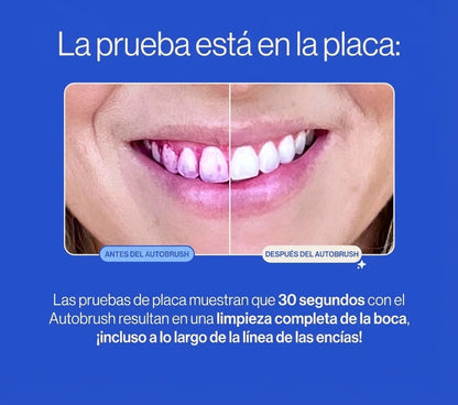 Paquete Cepillo Automatico® De Ultra Sonido Pro: Para Niño